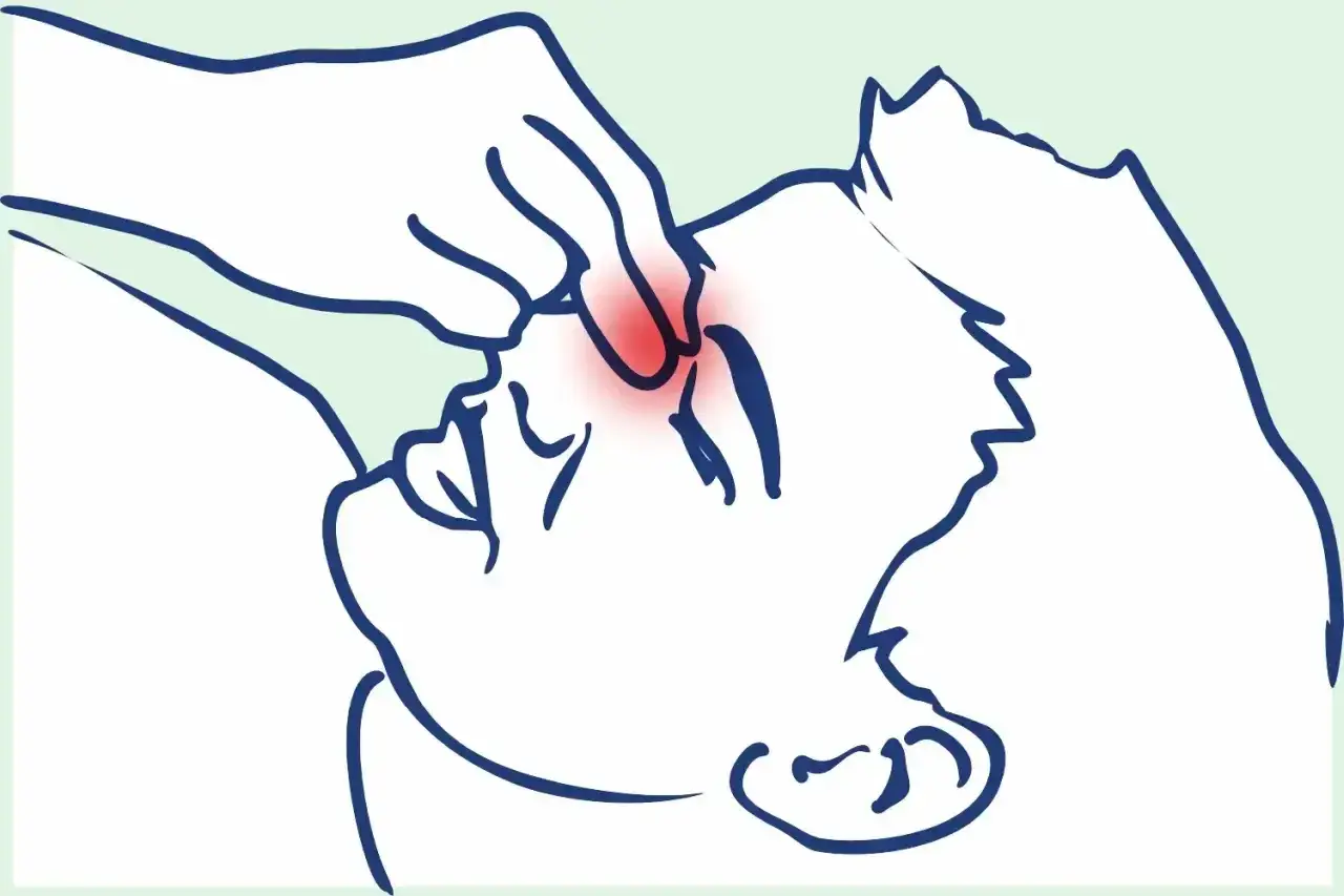 Skuteczne sposoby na ból zatok bez kataru, które przynoszą ulgę