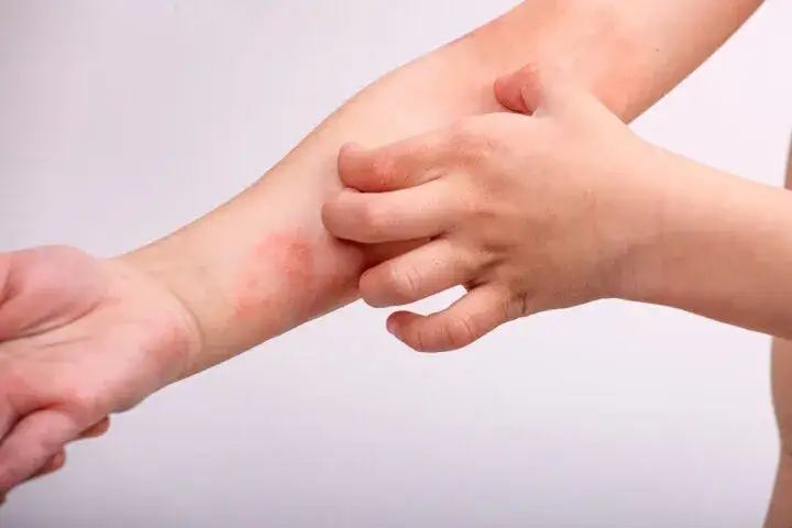 Zapalenie tkanki tłuszczowej: 6 objawów łatwych do przeoczenia