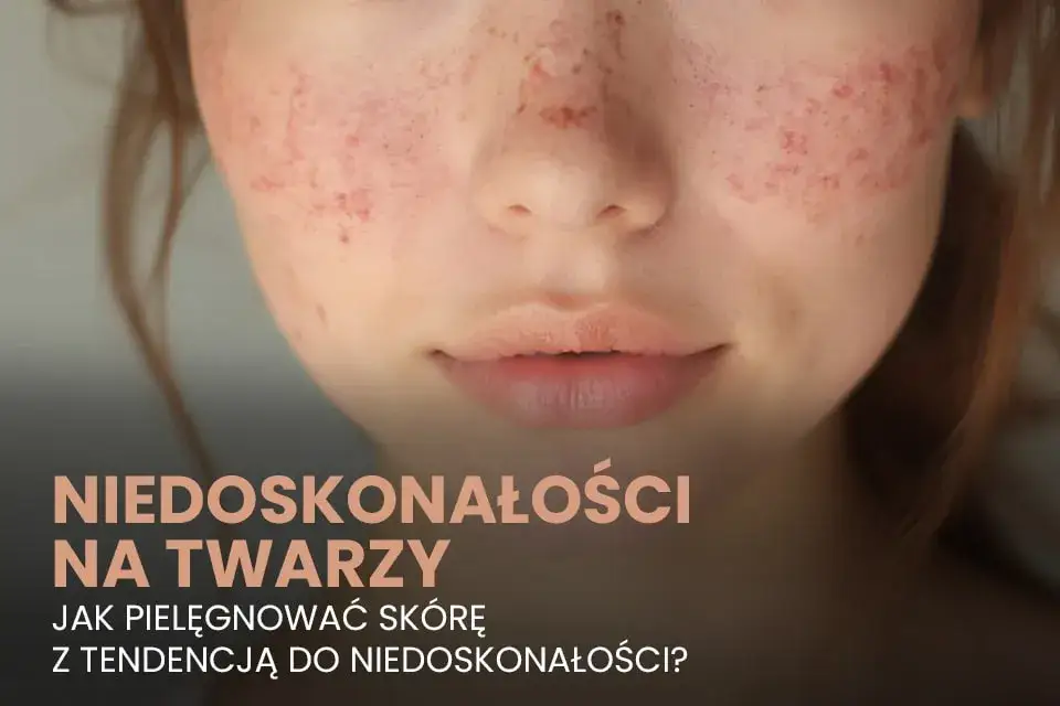 Jak zakryć pryszcze skutecznie i uniknąć widocznych niedoskonałości