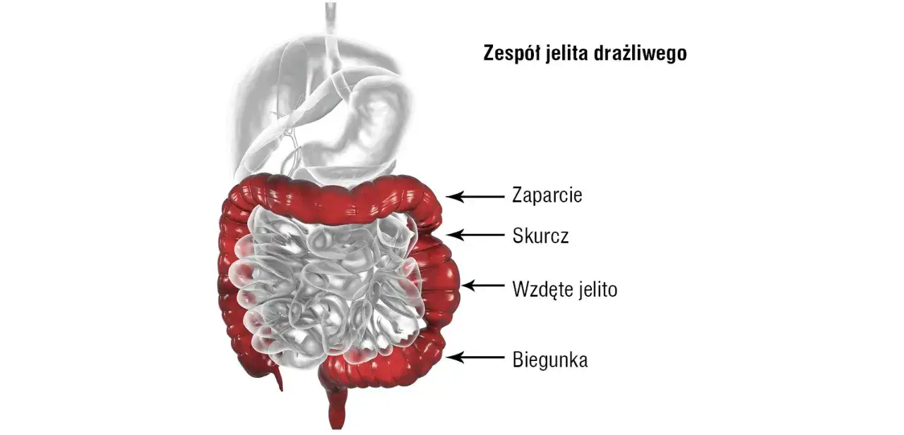 Zaburzenia motoryki jelit: objawy, przyczyny i kiedy szukać pomocy