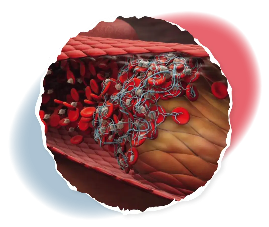Polycythaemia vera symptome: Erkennen Sie die versteckten Warnsignale