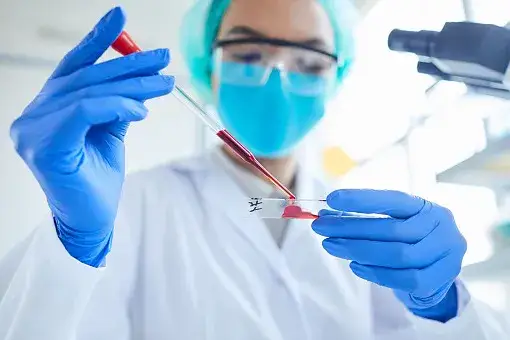 Jakie badania krwi w kierunku udaru mogą uratować życie?