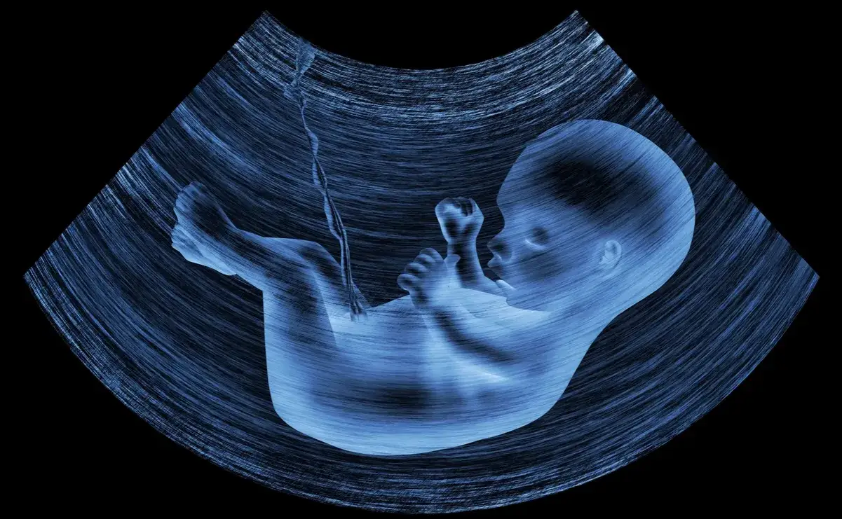 Czy zespół Downa można wykryć na USG? Kluczowe informacje i objawy