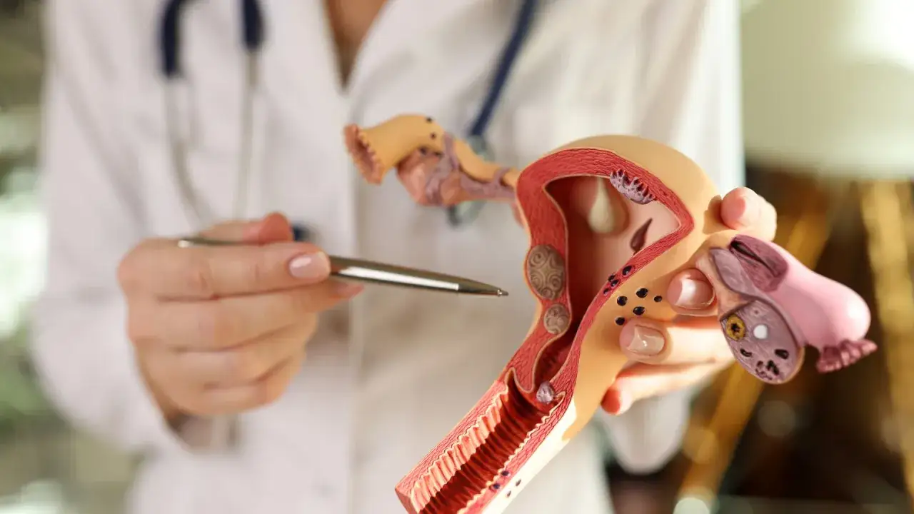 Lekarz wskazuje na model narządów rodnych kobiety, omawiając budowę endometrium.