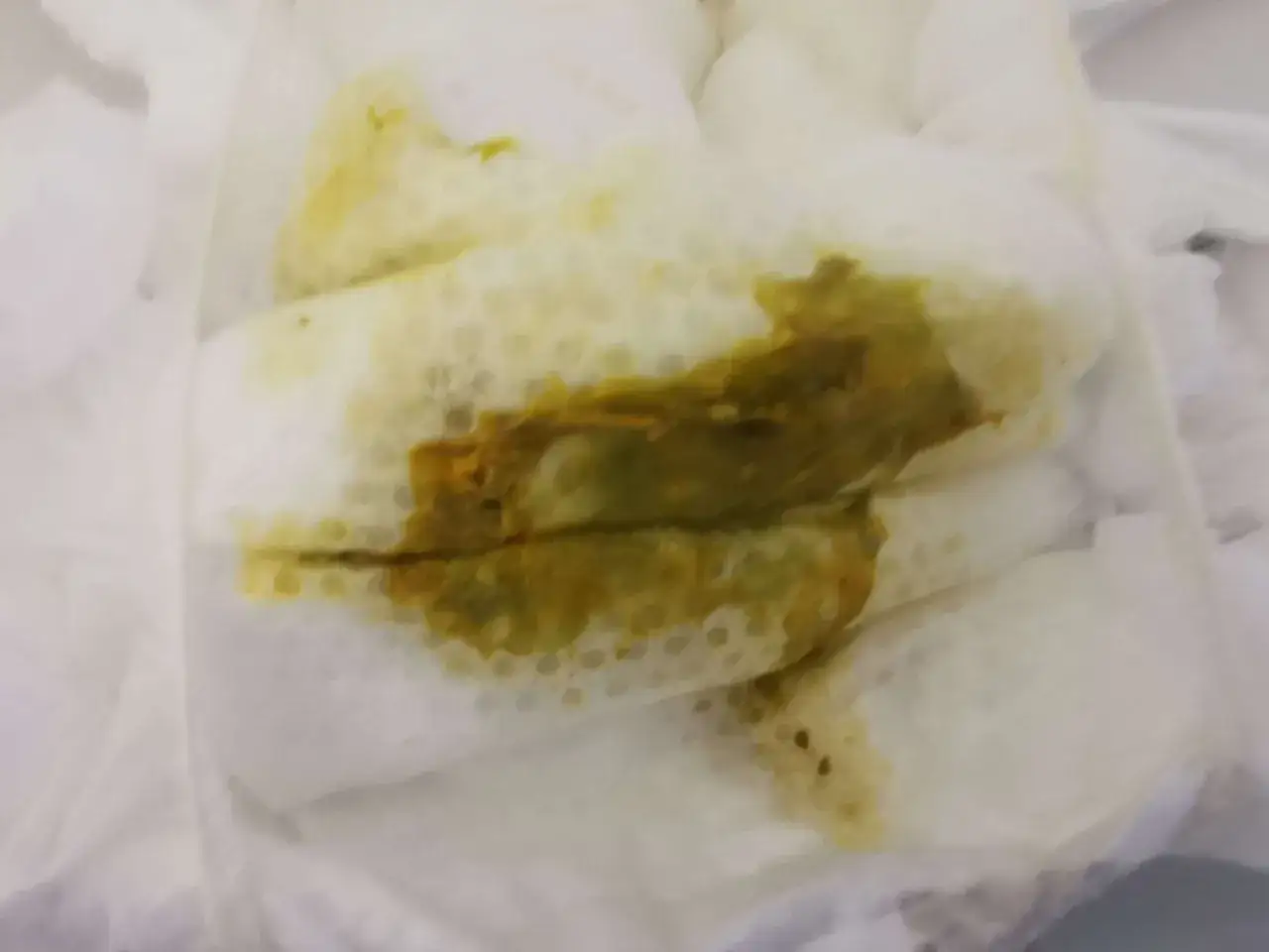 Jak wyglądają kupki przy ząbkowaniu? 7 ważnych informacji