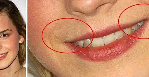 Jak usunąć włoski z twarzy? Skuteczne metody bez podrażnień