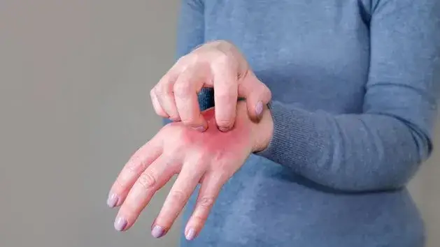 Czy manicure tytanowy uczula? Objawy i jak ich uniknąć