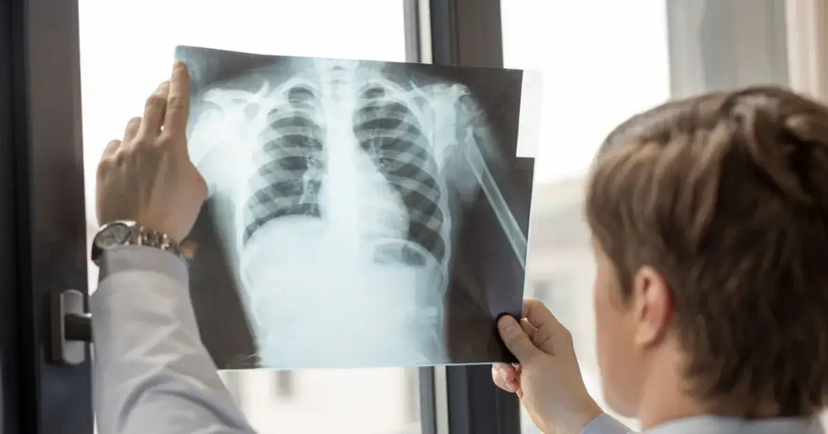 Sylwetka serca lewokomorowa – co to znaczy i jakie niesie zagrożenia