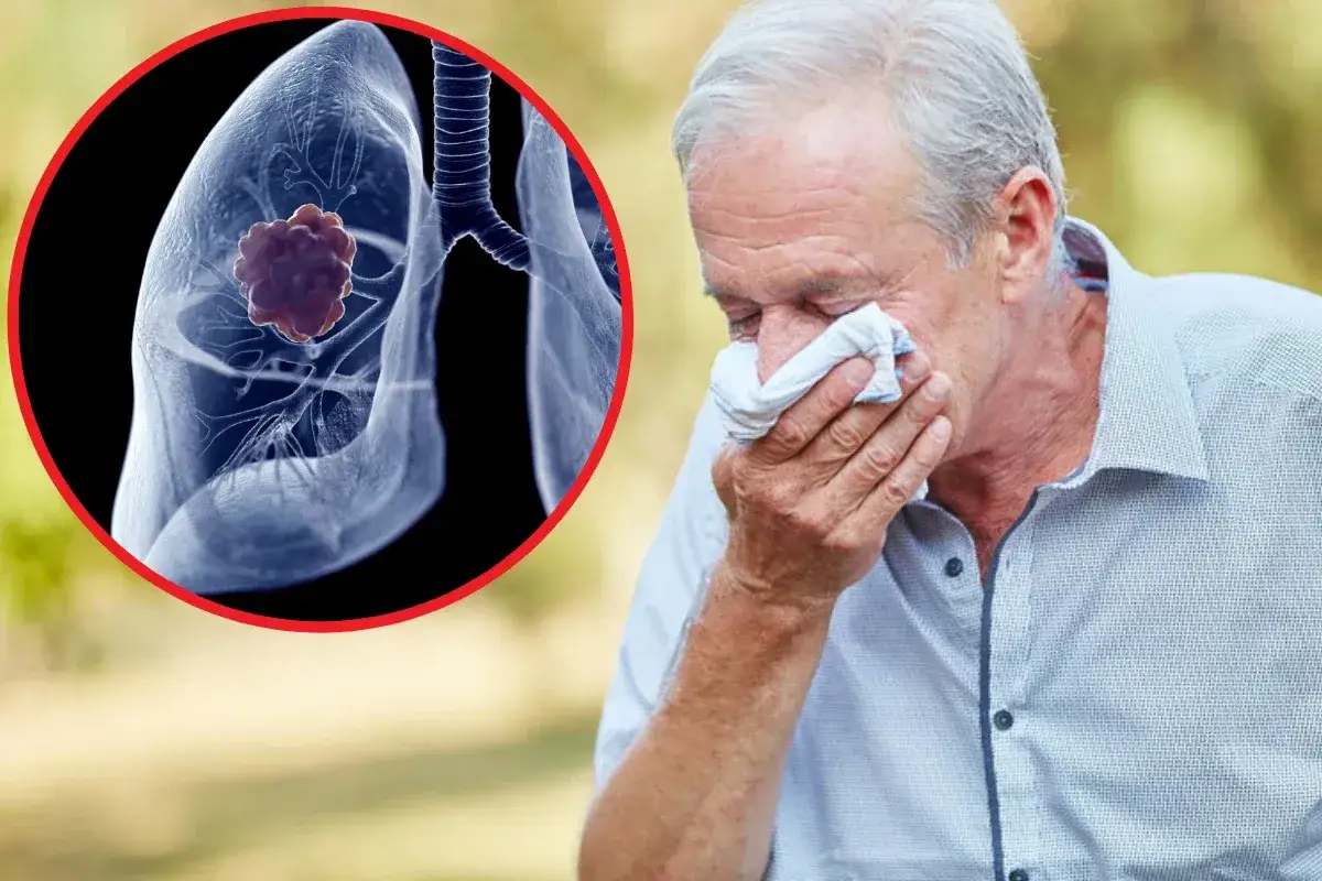 Objawy chorób płuc: Od kaszlu po raka. Kiedy iść do lekarza?