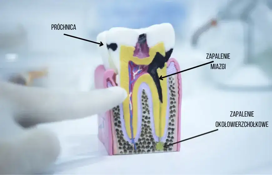 Boli ząb, nie wiesz który? Jak dentysta precyzyjnie znajdzie przyczynę