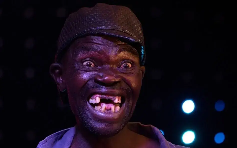 Najbrzydszy chłopak świata: Kim jest i dlaczego jest znany?