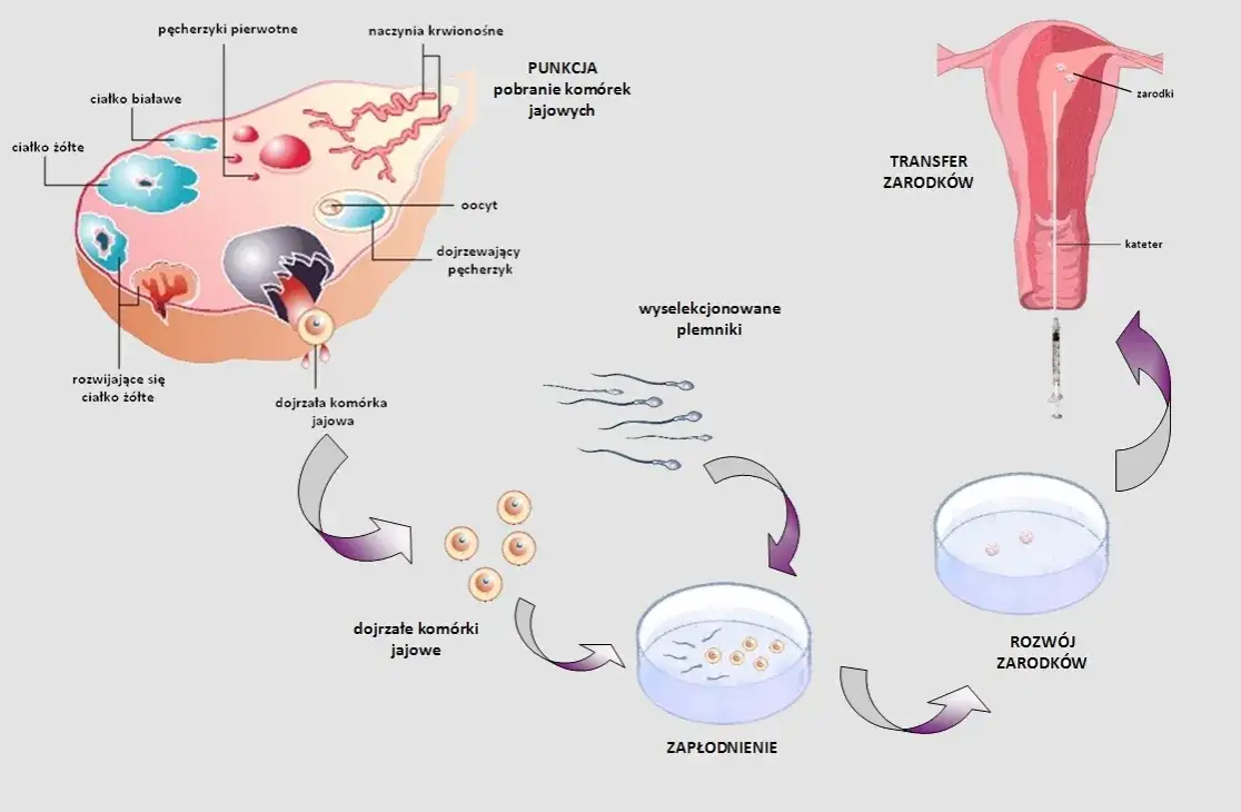 Ile można zarobić na oddaniu komórki jajowej? Poznaj prawdę o wynagrodzeniu