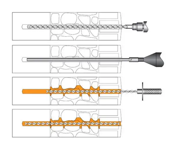 Kotwy do spinania murów – zastosowanie, rodzaje i korzyści dla budynków
