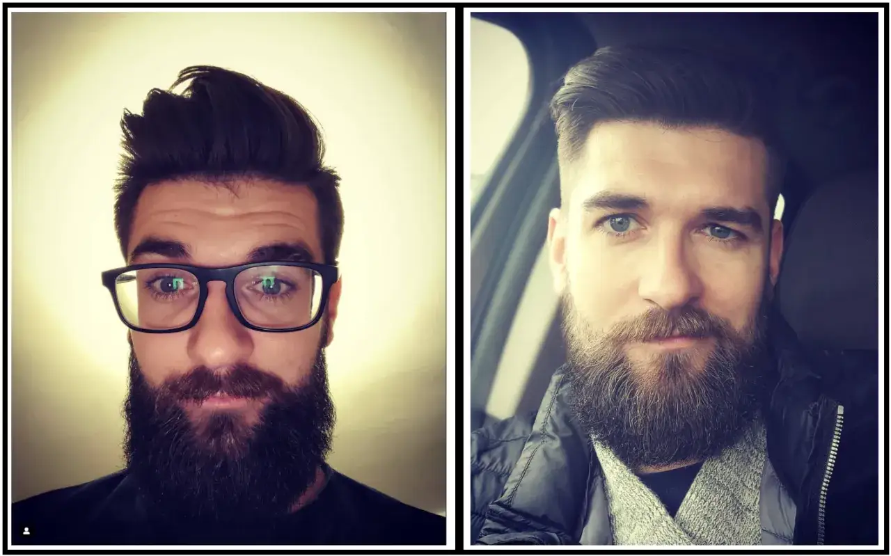 Chcesz gęsty zarost? Odkryj, jak przyspieszyć wzrost i obalić mity