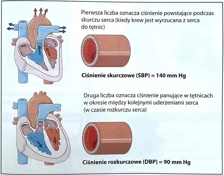 Nadciśnienie tętnicze objawy: jak rozpoznać groźne symptomy?