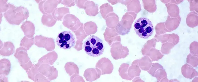 Podwyższony poziom neutrofili w ciąży - czy jest się czego obawiać?