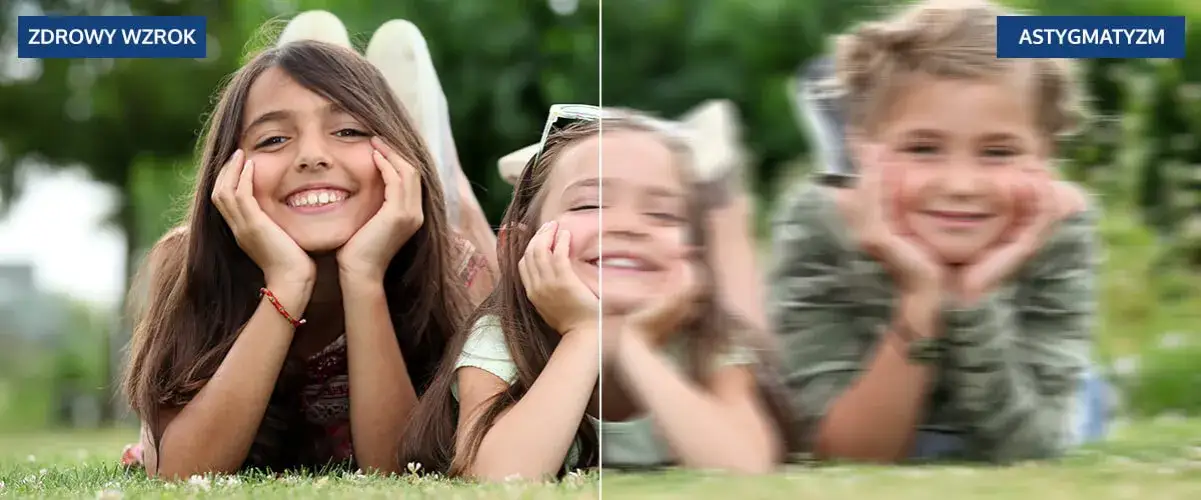Astygmatyzm: wyleczyć czy trwale skorygować? Poznaj prawdę!