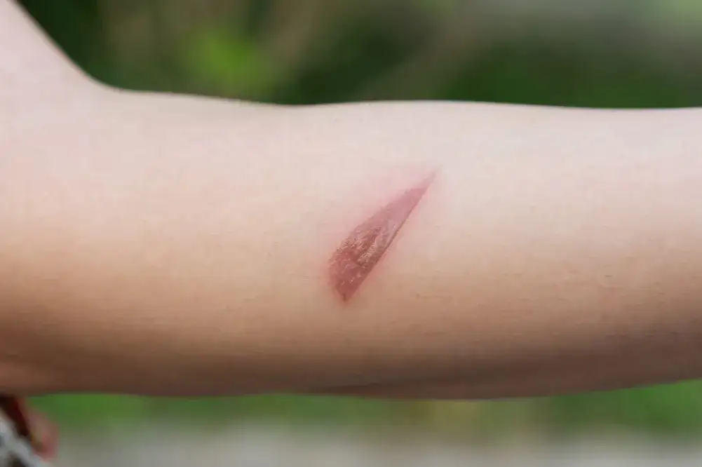 Dziecko się okalecza: psycholog czy psychiatra – co wybrać?