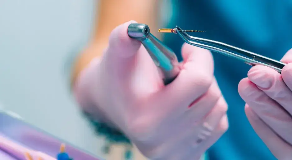 Leczenie kanałowe NFZ: które zęby możesz leczyć za darmo?