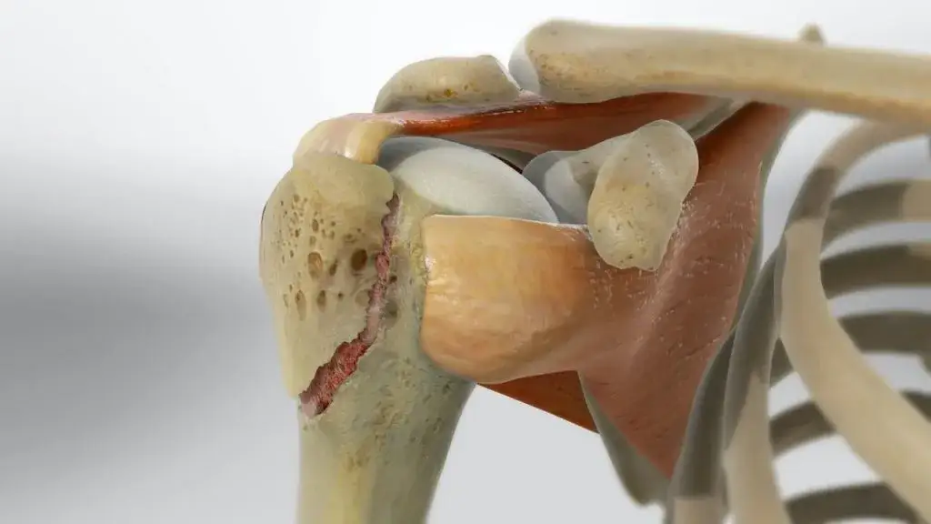 Kiedy zacząć rehabilitację po złamaniu kości ramiennej, by uniknąć bólu?