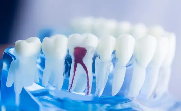 Ile korzeni ma ząb 4? Zaskakujące różnice między górnym a dolnym