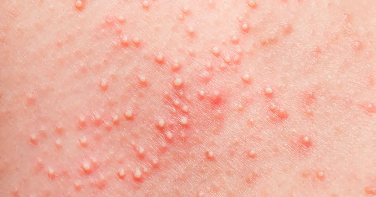 Niemowlę się poci? Poznaj przyczyny, objawy i jak pomóc