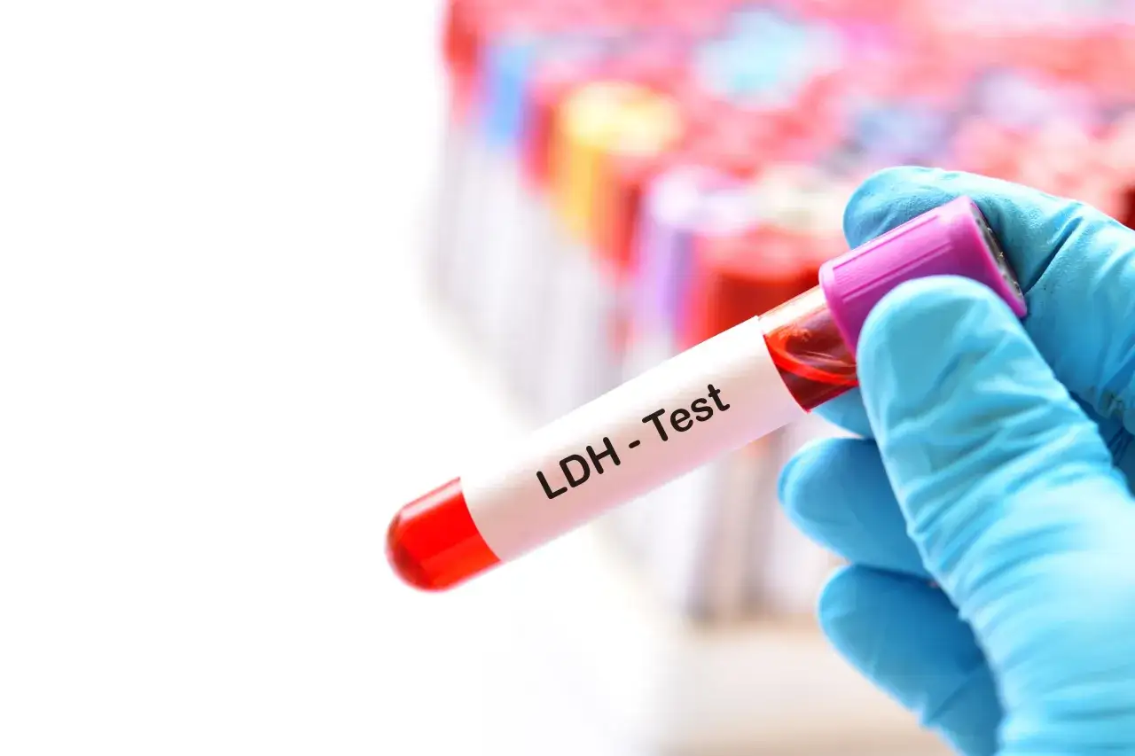 Podwyższony poziom LDH: Co oznacza i co dalej? Pełny przewodnik