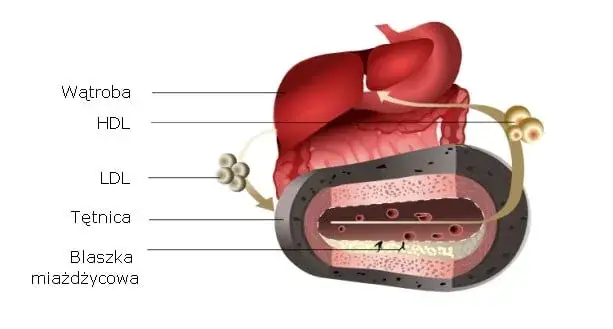 Jak obliczyć cholesterol resztkowy i zrozumieć jego znaczenie dla zdrowia