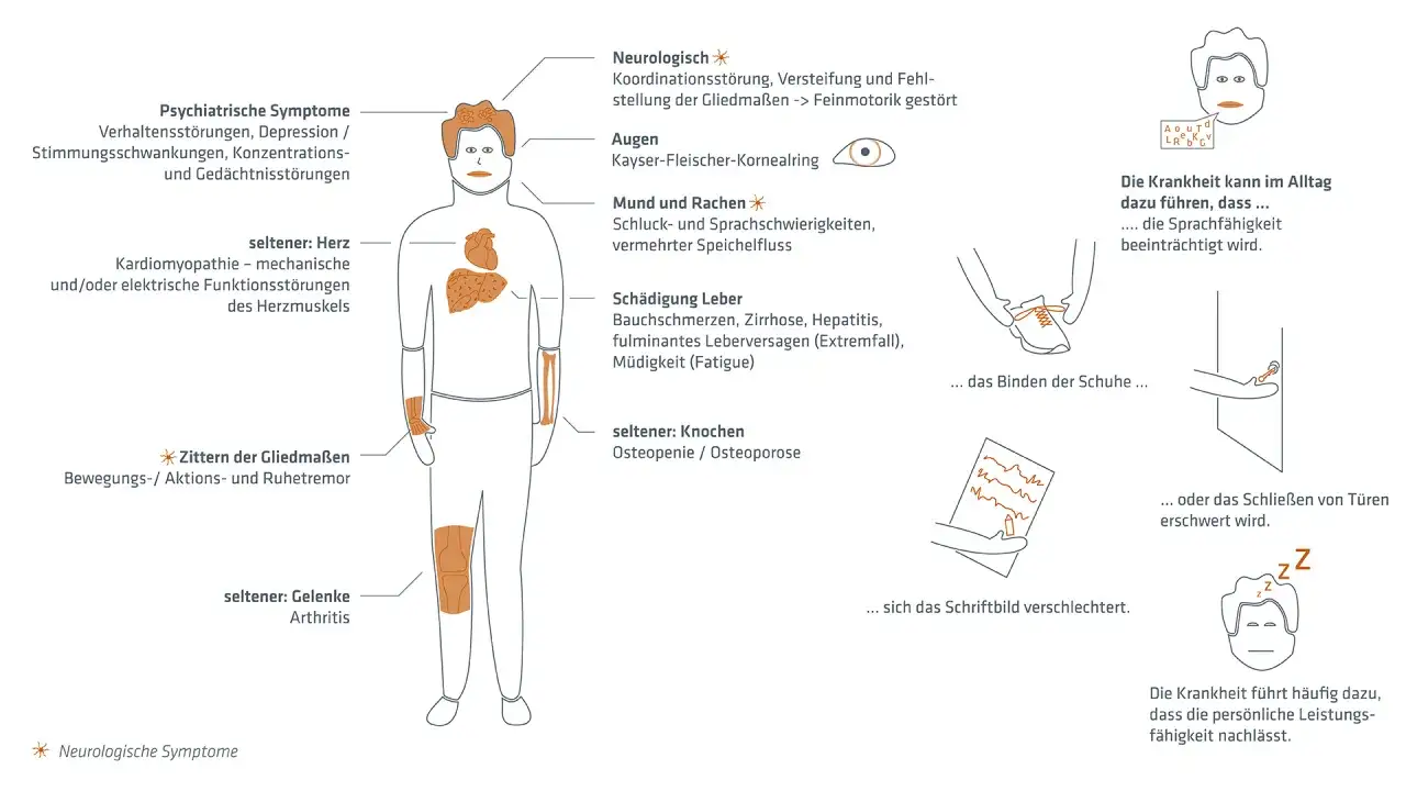 Morbus Wilson Diagnose: Schritte, Tests & Symptome erklärt