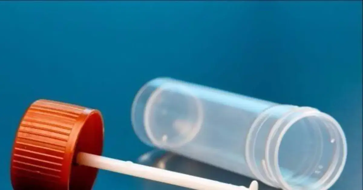 Co musisz wykluczyć z diety przed badaniem krwi utajonej w kale? Lista