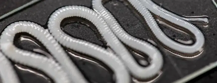 Tasiemiec objawy u człowieka – nie bagatelizuj tych sygnałów zdrowotnych