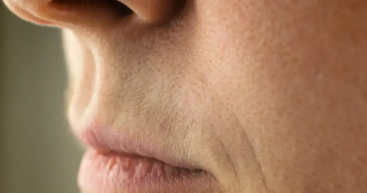 Jak usunąć wąsik żeby nie odrastał - skuteczne metody na zawsze