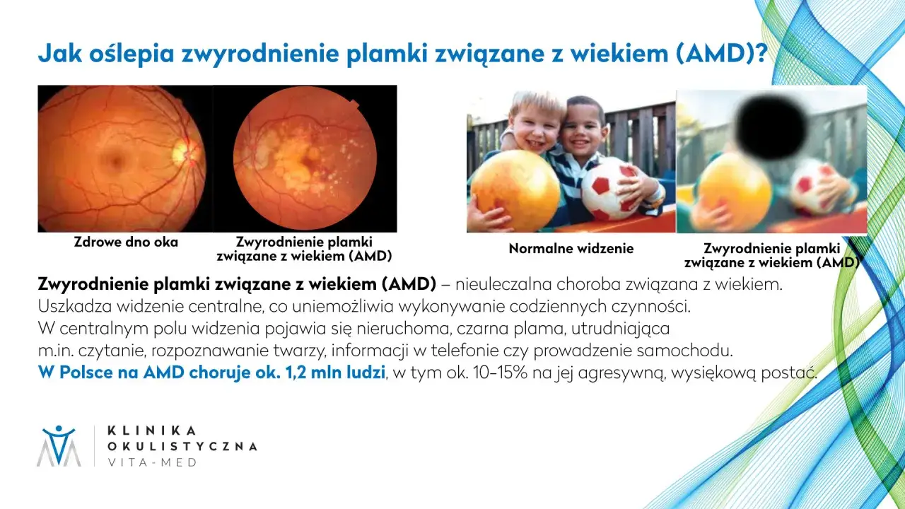 Badanie dna oka co wykrywa: zdrowe oko vs. zwyrodnienie plamki związane z wiekiem (AMD), wpływające na widzenie.
