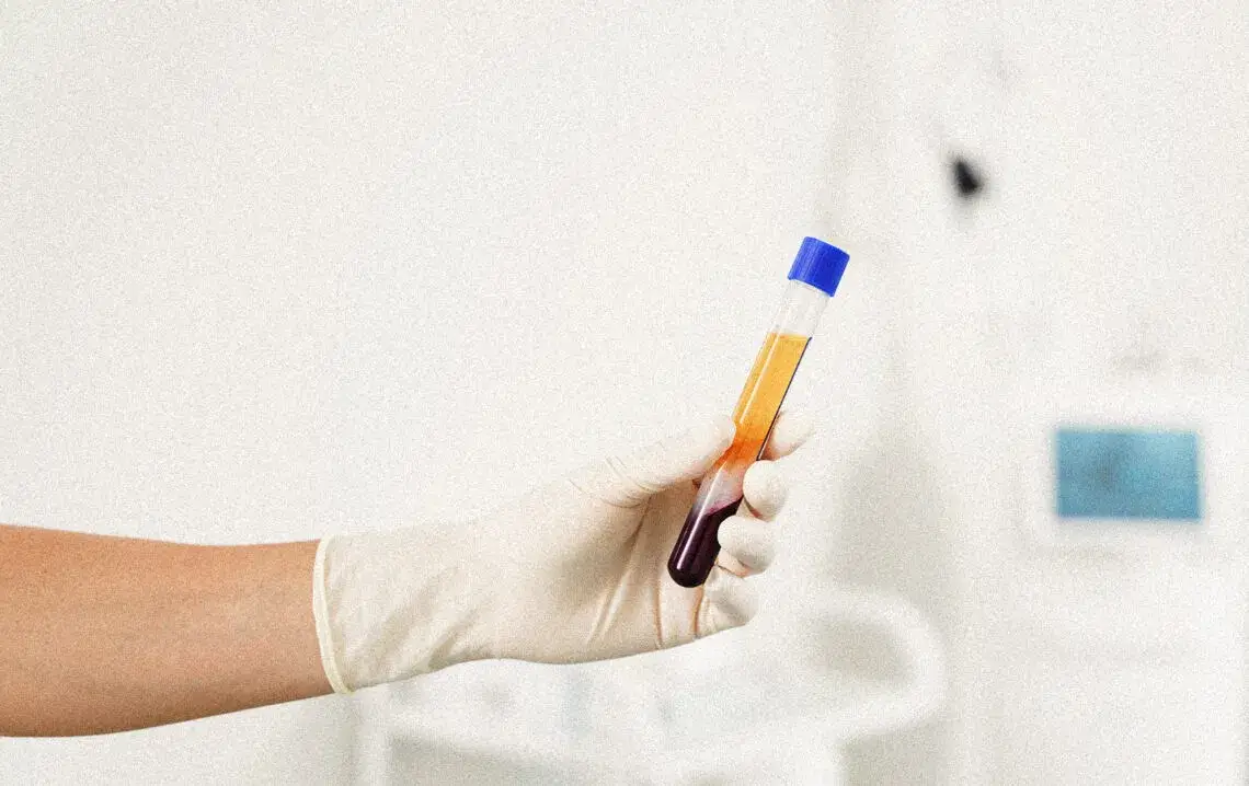 Jak wygląda badanie hbs w ciąży i co oznaczają jego wyniki?