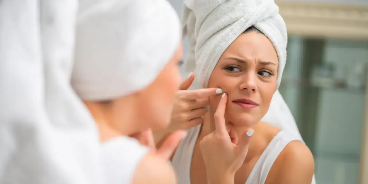 Wyciskanie pryszczy: Czy warto? Poznaj ryzyko i lepsze metody