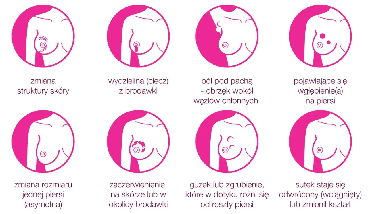Grafika pokazuje objawy raka piersi: guzek, zmiany skórne, wydzielinę z brodawki, ból, wgłębienia, asymetrię, zaczerwienienie i odwrócony sutek.