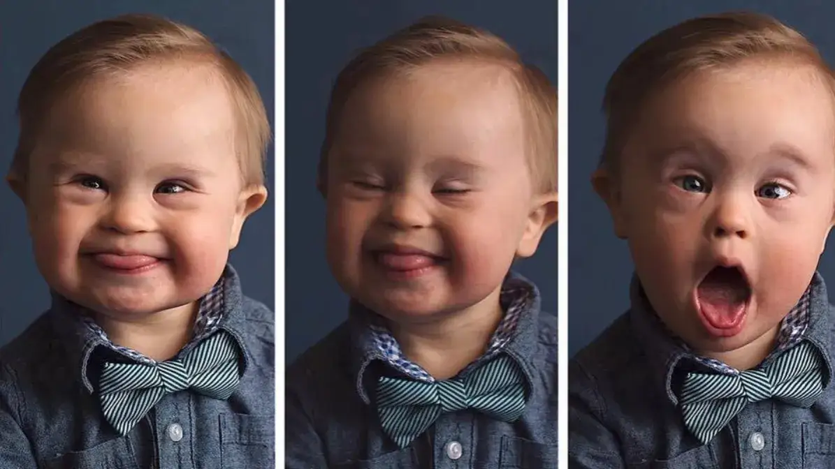 Jak adoptować dziecko z zespołem Downa - krok po kroku do szczęścia