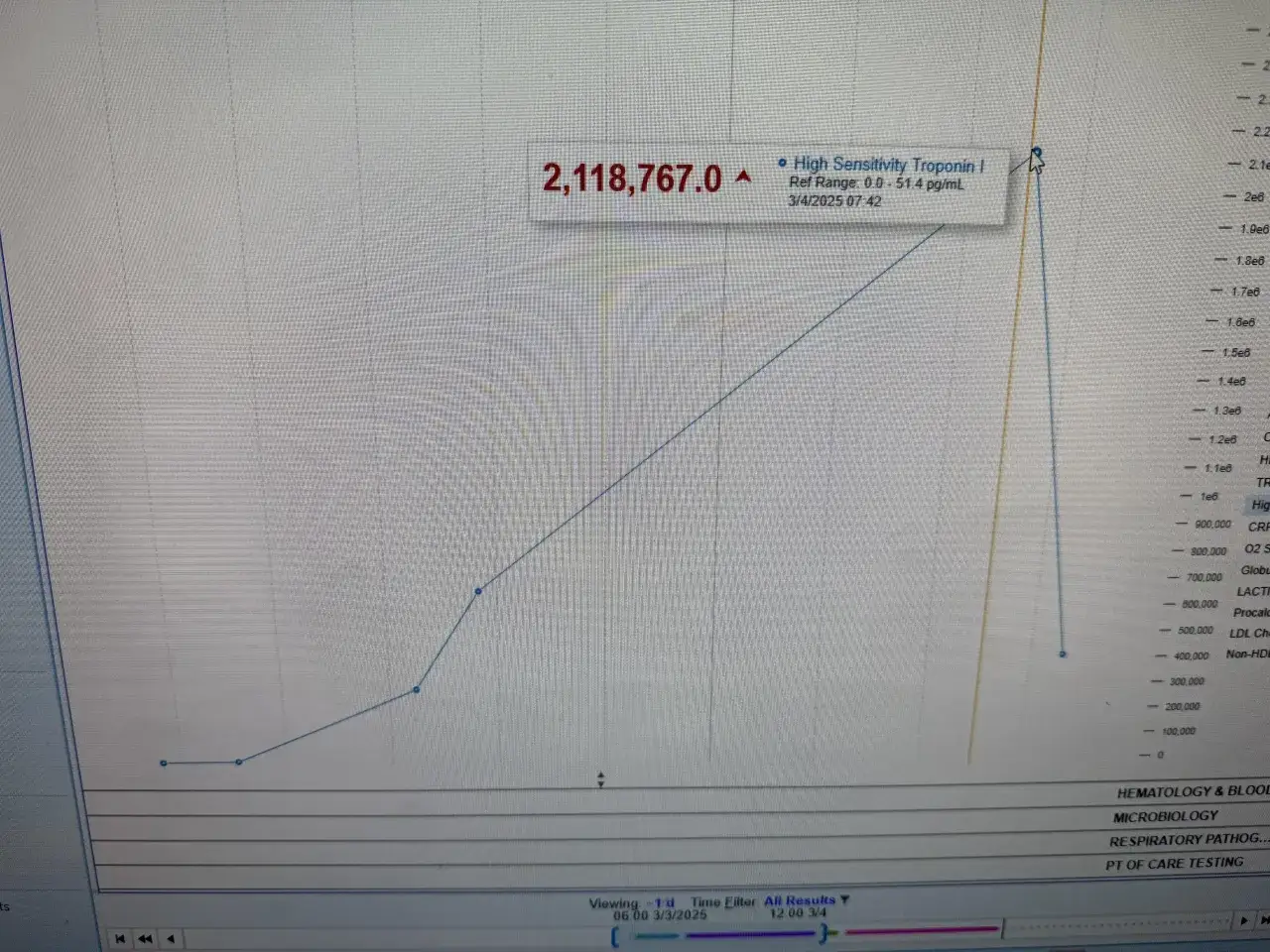Podwyższona troponina: Co oznacza? Zawał czy inna przyczyna?