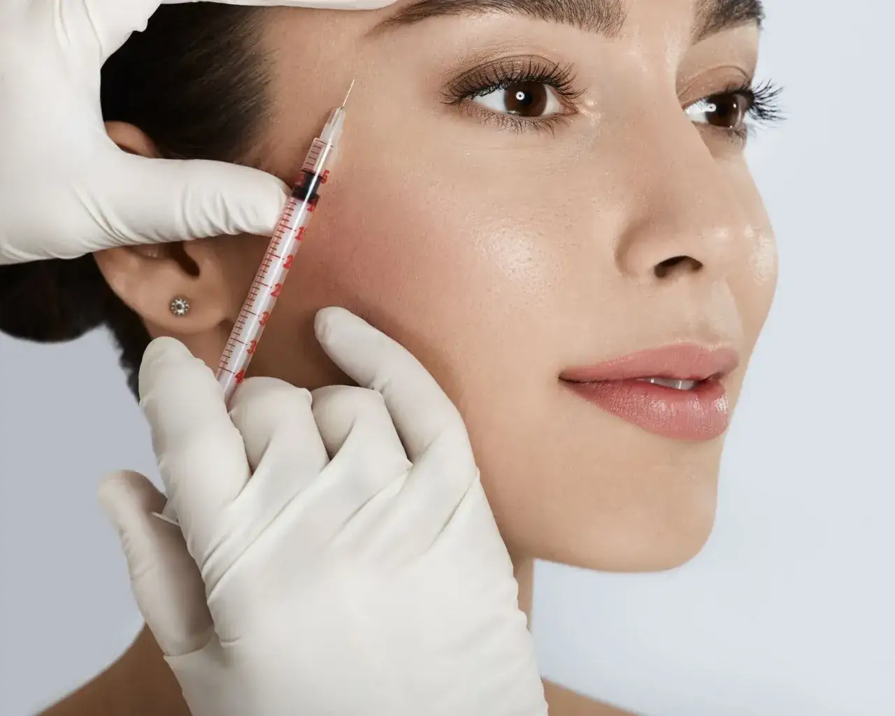 Kwas hialuronowy czy botox - który zabieg skuteczniej odmłodzi?