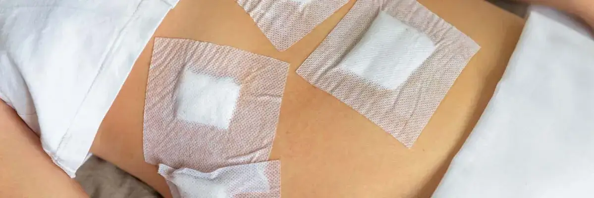 Plastry na rany pooperacyjne: Jak stosować? Oto poradnik pacjenta