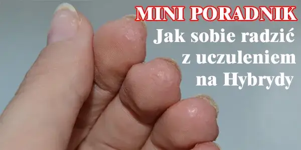 Uczulenie na hybrydę - jak rozpoznać objawy i co robić?