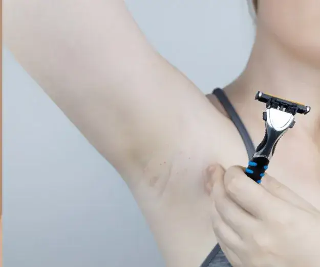 Skuteczne sposoby na podrażnienia po goleniu: najszybsze domowe metody