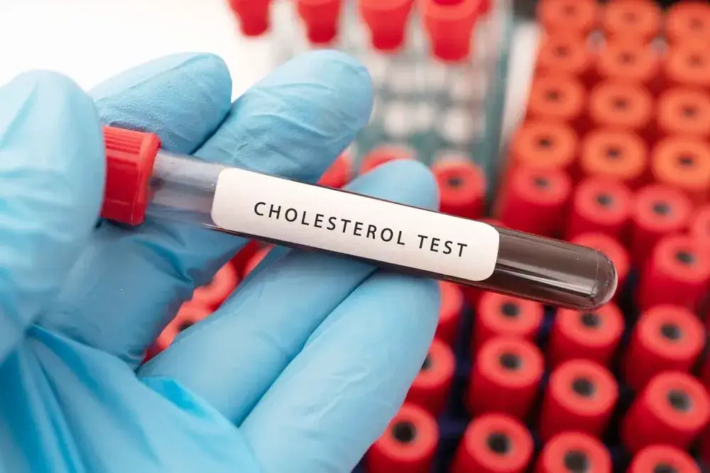 Jakie badanie na cholesterol wybrać, aby zadbać o zdrowie serca?