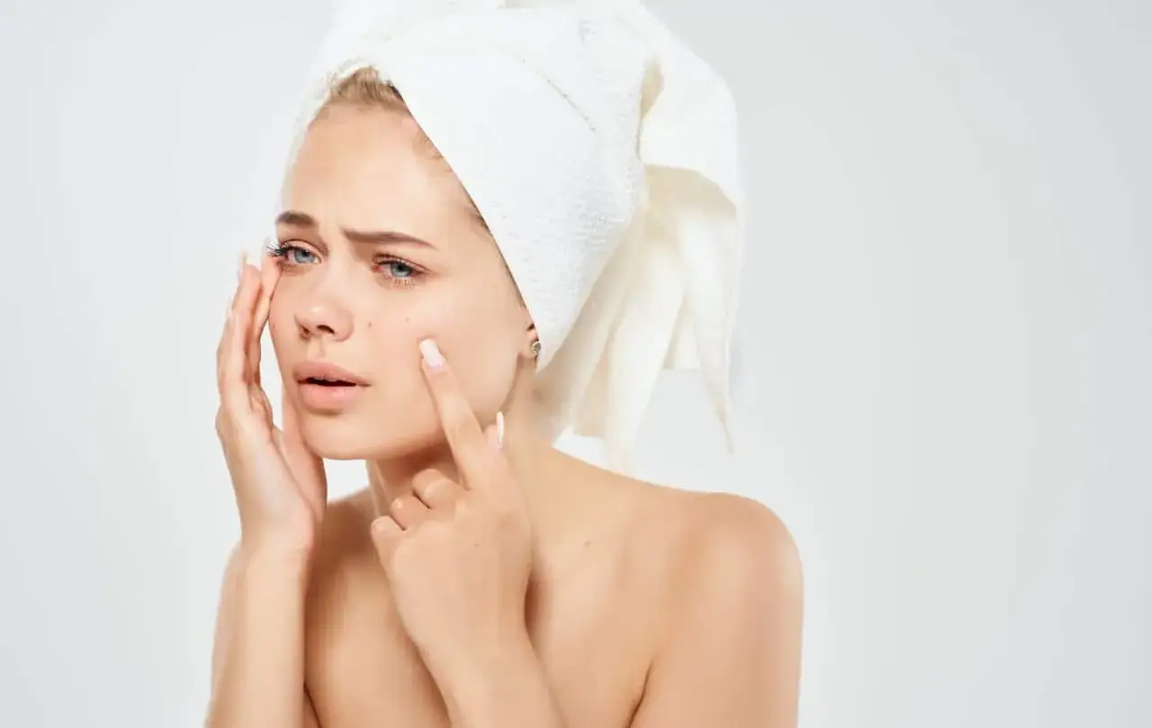 Jaki hydrolat do cery trądzikowej? Odkryj najlepsze rozwiązania dla skóry