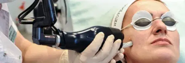 Kiedy znikają przebarwienia po laserze frakcyjnym? Oczekuj efektów