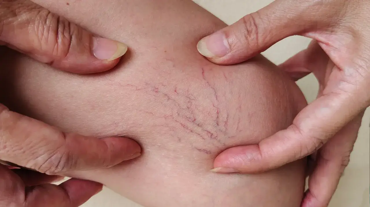 Objawy chorej wątroby i trzustki, które mogą zaskoczyć i zaniepokoić