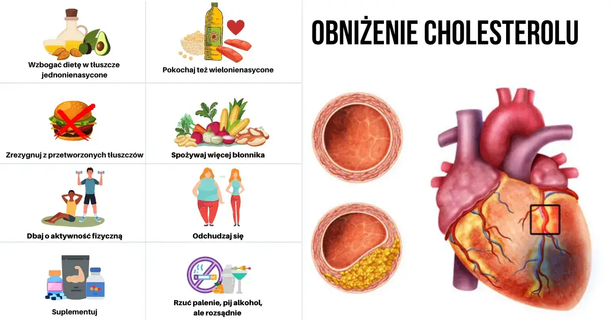 Jak szybko obniżyć cholesterol przed badaniem krwi – skuteczne metody w krótkim czasie