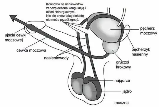 Czy wazektomia to grzech? Moralne i religijne aspekty zabiegu
