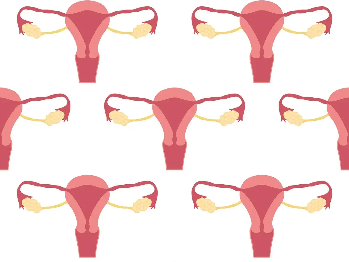 Podwyższony poziom CA 125 - co naprawdę oznacza w wynikach badań