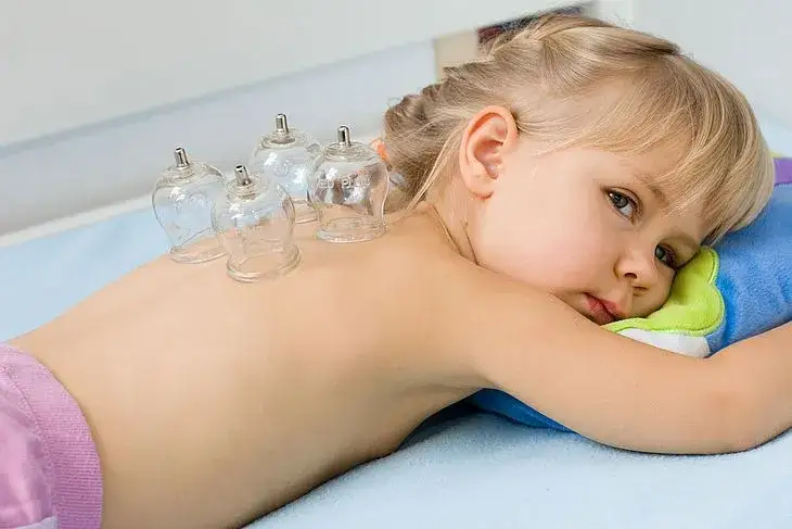 Częstotliwość stawiania baniek: Jak często można je stosować?